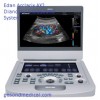 Edan Acclarix AX2 Dianostic Ultrasound System - Sale